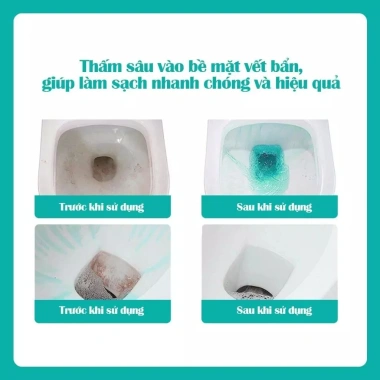 Nước Tẩy Bồn Cầu Flashman 500g – Khử khuẩn, không bết, thơm lâu, tẩy rửa toilet, giảm giá 45.000đ 3
