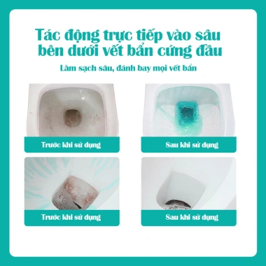 Nước tẩy bồn cầu Flashman 500ml - Diệt vi khuẩn, khử mùi, giá chỉ 55.000 VND 7