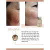 Nước Uống Collagen Skin Shot Bioactive – Chống Lão Hóa Da, Dưỡng Ẩm, Giá Ưu Đãi 2.206.400₫ 2