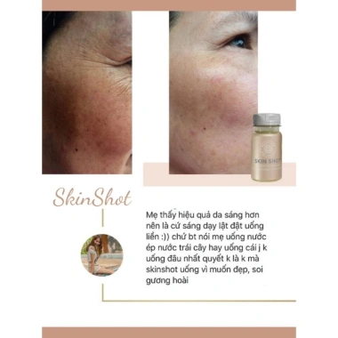 Nước uống Collagen Skin Shot Bioactive chống lão hoá da The Senses – Dưỡng da sâu, giảm nếp nhăn, giá ưu đãi 2.03 triệu 2