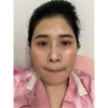 Obsal Mini 199k - Kem dưỡng trắng da, mờ thâm nám tàn hơi, chính hãng, chỉ 590k 9