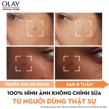 OLAY Luminous Niacinamide + Vitamin C - Kem 50g + Serum 30ml, Mờ Thâm, Đốm Nâu, Dưỡng Sáng Da 5