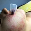 Ống hút mụn máu bầm spa 100 ống dày hút mạnh - Giá chỉ 79.000 VNĐ 6