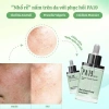PA19 Moisture Fluid Ampoule 50ml – Tinh Chất Phục Hồi Da Dưỡng ẩm, Giá Tết 1,190,000₫ 7