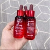 PEEL Da Hàn Quốc Peeling Solution - Căng bóng, săn chắc, không kích ứng, 289.000₫ 2