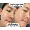 Peel Da Sinh Học SKY BIO - Dưỡng ẩm, Ngăn bong tróc da mặt và tay, 890.000 VND 9