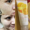 Peeling Gel Arahan 180ml - Tẩy Da Chết Sâu, Da Sáng Mịn, Giảm Giá Chỉ 75.000₫ 8