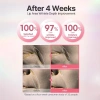 Petitfee Hydrogel Lip Mask 5 miếng Dưỡng môi Retinol Peptide Collagen Bakuchiol 6