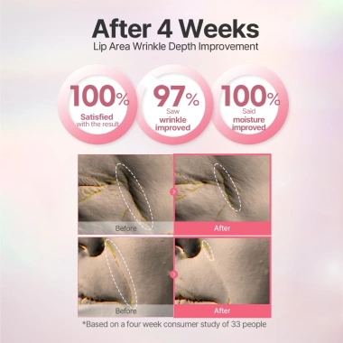 Petitfee Hydrogel Lip Mask 5 miếng Dưỡng môi Retinol Peptide Collagen Bakuchiol