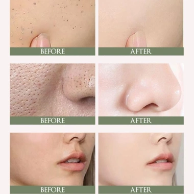 Petofq Lady Face Cream Kem Gel tẩy tế bào chết nhẹ, không kích ứng, Collagen cho da nữ - Giá chỉ 57.090đ