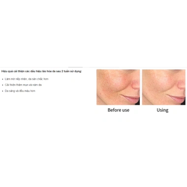 Pharmaform Tinh chất C Smoothing Serum Vitamin C 10% AHA Dưỡng sáng da, giảm nám, 30ml Giá 288.000đ