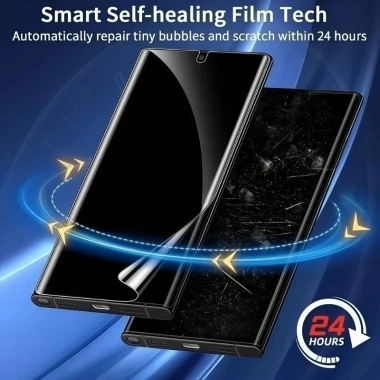 Phim Hydrogel Chống Ánh Sáng Xanh cho Redmi Note 13-15 4G/5G - Bảo Vệ Màn Hình 4 Phim Hydrogel Chống Ánh Sáng Xanh cho Redmi Note 13-15 4G/5G - Bảo Vệ Màn Hình 4