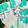 QrhYK 51 miếng dán mụn da mặt, phai màu vết mụn, đóng mụn nhanh, giảm 20% 3