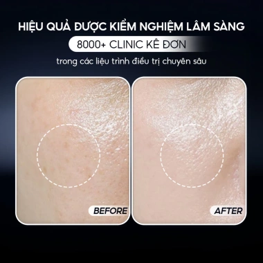 Sáp Peel Da Sinh Học aXENDA ROUTINER 75ml – Loại Bỏ Tế Bào Chết, Dưỡng Da, Giảm Giá 1.2 Triệu
