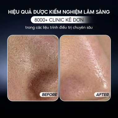 Sáp Peel Da Sinh Học aXENDA ROUTINER 75ml – Loại Bỏ Tế Bào Chết, Dưỡng Da, Giảm Giá 1.2 Triệu 3 Sáp Peel Da Sinh Học aXENDA ROUTINER 75ml – Loại Bỏ Tế Bào Chết, Dưỡng Da, Giảm Giá 1.2 Triệu 3