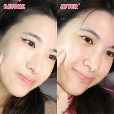 Sáp Tẩy Trang Banila Co Clean It Zero 100ml Dưỡng ẩm Không Bít Tắc Giá giảm 408.000₫ 7 Sáp Tẩy Trang Banila Co Clean It Zero 100ml Dưỡng ẩm Không Bít Tắc Giá giảm 408.000₫ 7