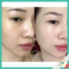 Serum ADORA chính hãng 100% giảm nhăn, nám sạm, chống lão hóa, căng mịn da 35ml - Giá ưu đãi 278.000₫ 7