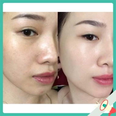 Serum ADORA chính hãng 100% giảm nhăn, nám sạm, chống lão hóa, căng mịn da 35ml - Giá ưu đãi 278.000₫