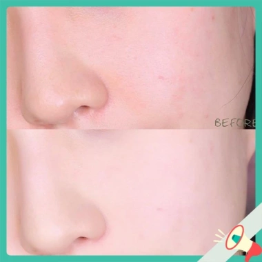 Serum ADORA chính hãng 100% giảm nhăn, nám sạm, chống lão hóa, căng mịn da 35ml - Giá ưu đãi 278.000₫