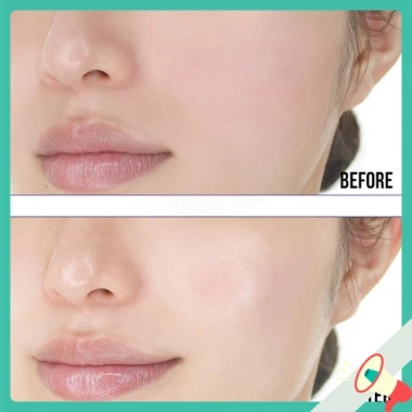 Serum ADORA chính hãng 100% giảm nhăn, nám sạm, chống lão hóa, căng mịn da 35ml - Giá ưu đãi 278.000₫