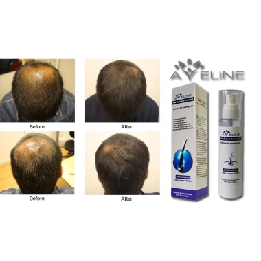 Serum Aveline Mỹ - Kích mọc tóc mạnh, nhanh, dày chắc, chính hãng 1.8tr