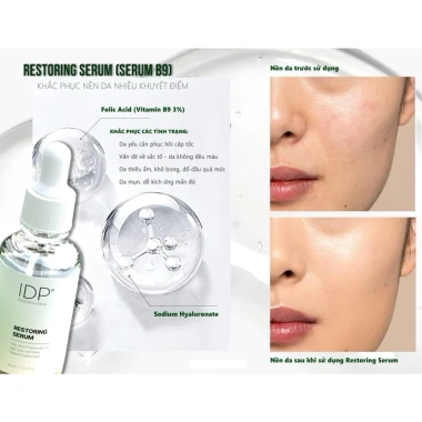 Serum B9 Restoring IDP 30ml – Phục hồi da, cấp ẩm sâu, giảm còn 495.000₫ 4