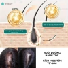 Serum Bio-placental Dưỡng Nang Tóc & Da Đầu, Lăn Kim Tay 0.5mm - Tiết Kiệm 38K, Chỉ 120k 5
