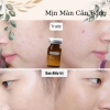 Serum BioK CareCella Tế Bào Gốc nội sinh hàng chuẩn, siêu phục hồi da sau vi kim, chỉ 189.000₫ 5