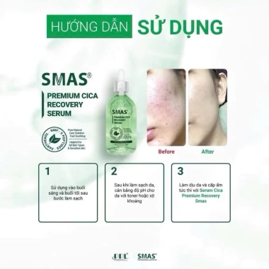Serum Cấp Ẩm B5 Hydra 120ml - Dưỡng ẩm, Phục hồi da, CICA ngừa mụn, chỉ 490k