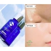 Serum Cấp Nước IS Clinical Hydra Cool 30ml - Dưỡng ẩm sâu, làm mát da, chỉ 1.215.000₫ 4