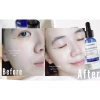 Serum cấp nước Mesoestetic HA Densimatrix 30ml - Dưỡng ẩm, chống lão hóa, da tươi trẻ 5