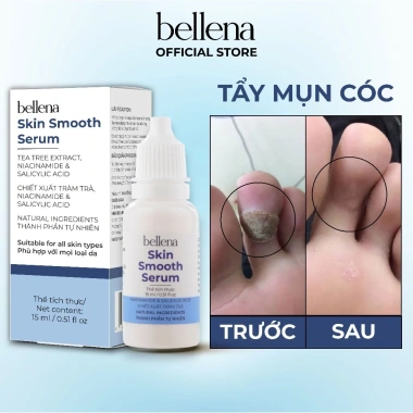 Serum chấm bôi Bellena SC1 trị mụn, cóc, mụn thịt, vết chai, sần giảm giá 137k