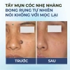 Serum chấm bôi Bellena SC1 trị mụn, cóc, mụn thịt, vết chai, sần giảm giá 137k 3