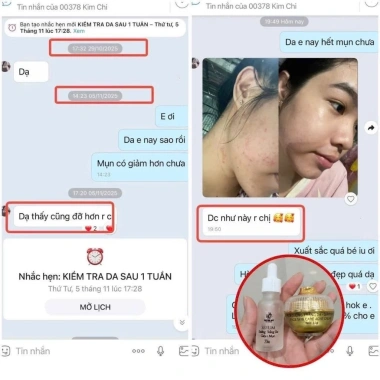 Serum Chấm Mụn 12H Huỳnh Đỗ - Giảm Mụn, Khô Còi, Dưỡng Trắng & Tái Tạo Da, Giá 135k 3
