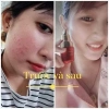 Serum Chấm Mụn 12H Huỳnh Đỗ - Giảm Mụn, Khô Còi, Dưỡng Trắng & Tái Tạo Da, Giá 135k 6
