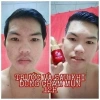 Serum Chấm Mụn 12H Huỳnh Đỗ - Giảm Mụn, Khô Còi, Dưỡng Trắng & Tái Tạo Da, Giá 135k 7