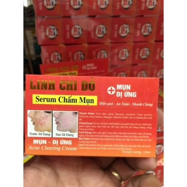 Serum chấm mụn LINH CHI ĐỎ 10ml: Giảm mụn nhanh, không gây khô, giá chỉ 53.000đ
