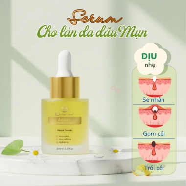 Serum Doctor Care Acne 7ml/20ml – Dưỡng da dầu, ngừa mụn, mờ thâm, thấm nhanh, chỉ 139.000₫ 4