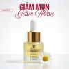 Serum Doctor Care Acne 7ml/20ml – Dưỡng da dầu, ngừa mụn, mờ thâm, thấm nhanh, chỉ 139.000₫ 8
