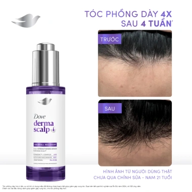 Serum Dove Derma Hairfall Recovery 3‑in‑1 Giảm Rụng Tóc, Tăng Độ Dày Phồng 45ml Mạnh Mẽ