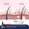 Serum Dr.PONG Tsutsuji - Giảm rụng tóc, kích thích mọc tóc, chăm sóc da đầu, giá chỉ 675.000₫ 3