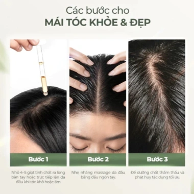 Serum Dưỡng Tóc Lab On Hair 60ml - Tinh Chất Mọc Tóc, Ngăn Rụng, Giá 185,220₫ 6