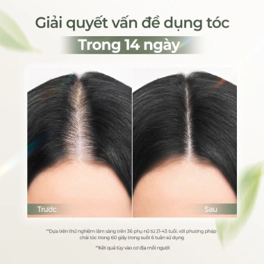 Serum Dưỡng Tóc Lab On Hair 60ml - Tinh Chất Mọc Tóc, Ngăn Rụng, Giá 185,220₫ 7