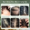 Serum Dưỡng Tóc Lab On Hair 60ml - Tinh Chất Mọc Tóc, Ngăn Rụng, Giá 185,220₫ 8