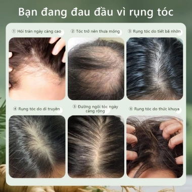 Serum Dưỡng Tóc Lab On Hair 60ml - Tinh Chất Mọc Tóc, Ngăn Rụng, Giá 185,220₫ 8