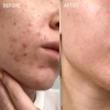 Serum Dưỡng Trắng B5 Hydra Max PrettySkin - Dưỡng ẩm, phục hồi, da thô ráp - Giá 465.000₫ giảm 20% - Cuckushop 9