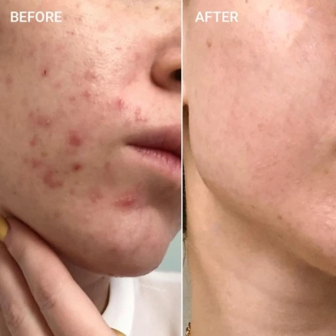 Serum Dưỡng Trắng B5 Hydra Max PrettySkin - Dưỡng ẩm, phục hồi, da thô ráp - Giá 465.000₫ giảm 20% - Cuckushop
