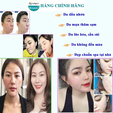 Serum EGF Dr.lavic Step 3: Tái tạo, phục hồi da, lành sẹo, trắng da - 318.000₫ 4