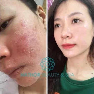 Serum EGF Vira Ampoule 10ml Hathor Beauty: Dưỡng da, phục hồi, giảm giá 450k