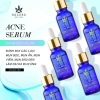 Serum Halora giảm mụn 3 tặng 1 - Rửa mặt mọi loại da, chỉ 470k giảm từ 582.800 3